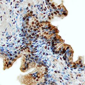 CLC antibody in Human Prostate by Immunohistochemistry (IHC-P).