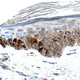 CLEC-2A antibody in Human Skin by Immunohistochemistry (IHC-P).