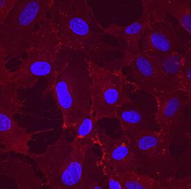 CLEC14A antibody in HUVEC Human Cells by Immunocytochemistry (ICC).