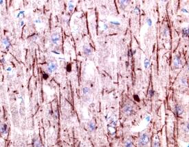 CNTF Ra antibody in Rat Brain by Immunohistochemistry (IHC-Fr).