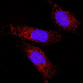 COMMD1 antibody in U2OS Human Cell Line by Immunocytochemistry (ICC).