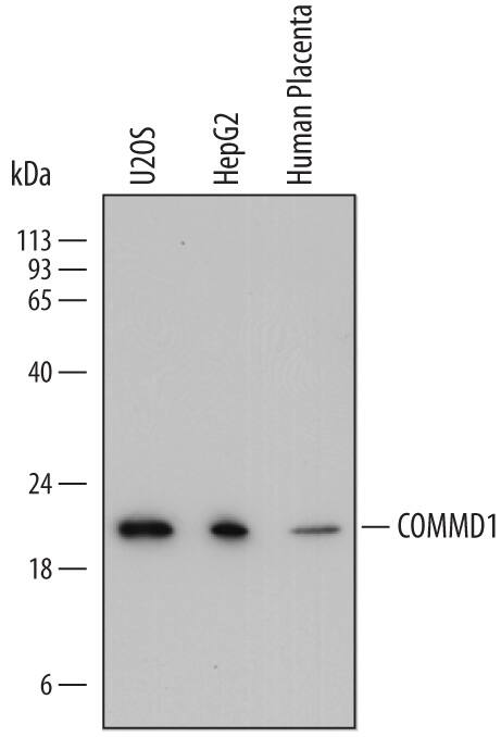 Detection of Human COMMD1 antibody by Western Blot.