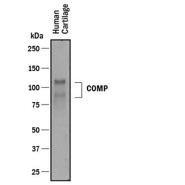 Detection of Human COMP/Thrombospondin-5 antibody by Western Blot.