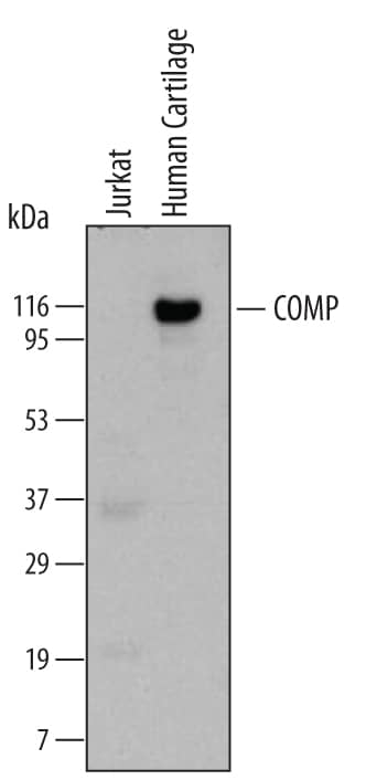 Detection of Human COMP/Thrombospondin-5 antibody by Western Blot.