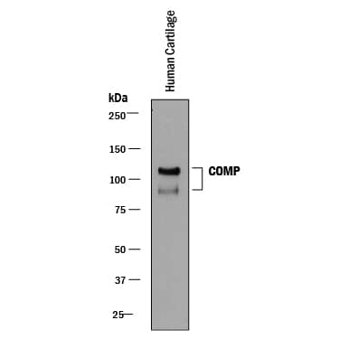 Detection of Human COMP/Thrombospondin-5 antibody by Western Blot.