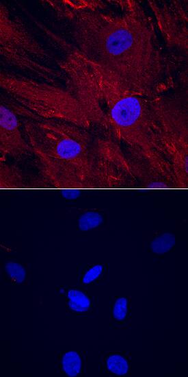 CTRP3/C1qTNF3/CORS26 antibody in Human Mesenchymal Stem Cells by Immunocytochemistry (ICC).