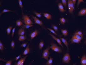 COX-2 antibody in HUVEC Human Cells by Immunocytochemistry (ICC).