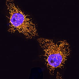 COX4-I1 antibody in HeLa Human Cell Line by Immunocytochemistry (ICC).