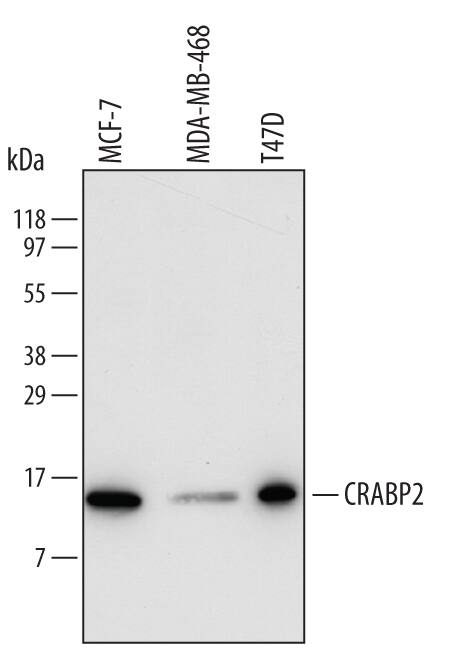 Detection of Human CRABP2 antibody by Western Blot.