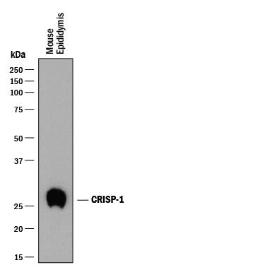 Detection of Mouse CRISP-1 antibody by Western Blot.