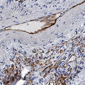 CRLR antibody in Human Lung by Immunohistochemistry (IHC-P).