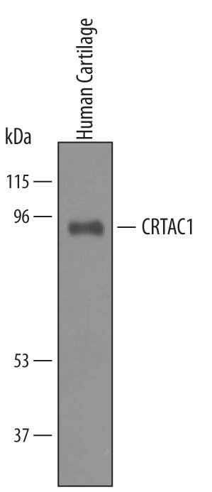 Detection of Human CRTAC1 antibody by Western Blot.