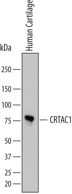 Detection of Human CRTAC1 antibody by Western Blot.