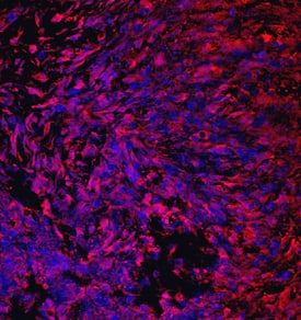 CRTAC1 antibody in Human Chondrocytes by Immunocytochemistry (ICC).