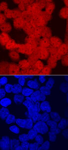 CRX antibody in Y-79 Human Cell Line by Immunocytochemistry (ICC).