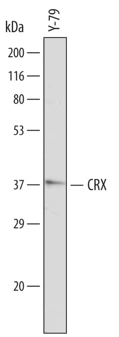 Detection of Human CRX antibody by Western Blot.