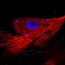 C-Reactive Protein/CRP antibody in BG01V Human Embryonic Stem Cells by Immunocytochemistry (ICC).