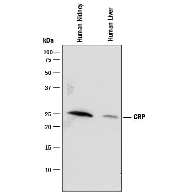 Detection of Human C-Reactive Protein/CRP antibody by Western Blot.