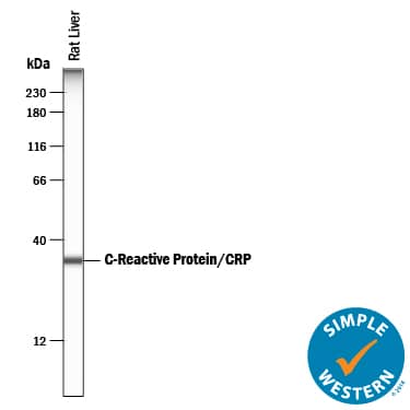 Detection of Rat C-Reactive Protein/CRP antibody by Simple WesternTM.