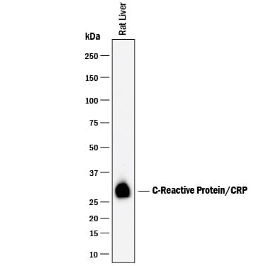 Detection of Rat C-Reactive Protein/CRP antibody by Western Blot.