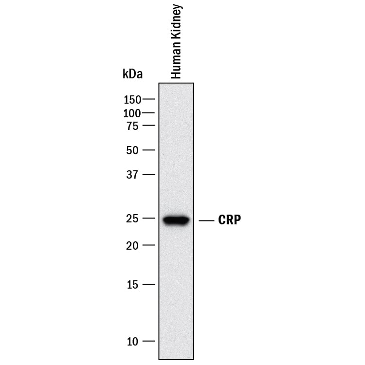 Detection of Human C-Reactive Protein/CRP antibody by Western Blot.