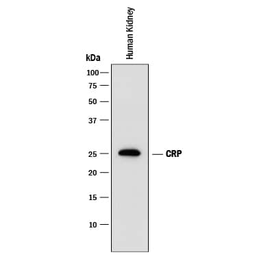 Detection of Human C-Reactive Protein/CRP antibody by Western Blot.