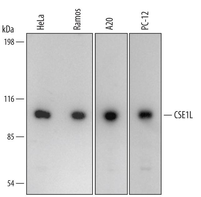 Detection of Human/Mouse/Rat CSE1L/CAS antibody by Western Blot.