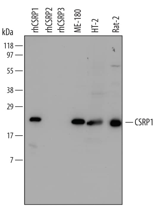 Detection of Human, Mouse, and Rat CSRP1 antibody by Western Blot.