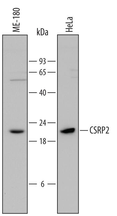 Detection of Human CSRP2 antibody by Western Blot.