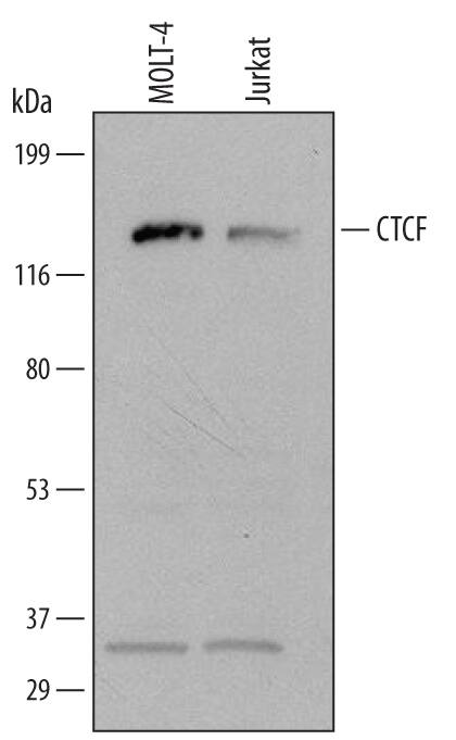 Detection of Human CTCF antibody by Western Blot.