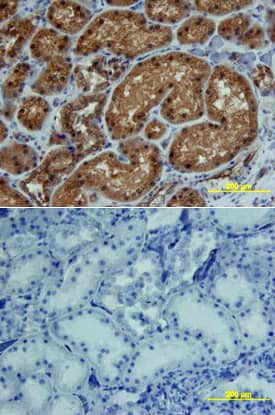 CTGF/CCN2 antibody in Human Kidney by Immunohistochemistry (IHC-P).