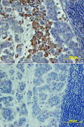 CTGF/CCN2 antibody in Human Pancreas by Immunohistochemistry (IHC-P).
