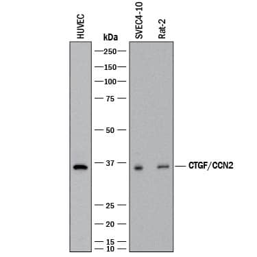 Detection of Human, Mouse, and Rat CTGF/CCN2 antibody by Western Blot.