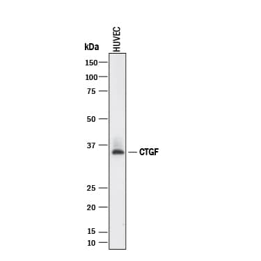 Detection of Human CTGF/CCN2 antibody by Western Blot.