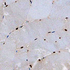 CUGBP1/CELF1 antibody in Human Skeletal Muscle by Immunohistochemistry (IHC-P).