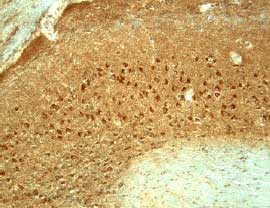 CX3CL1/Fractalkine antibody in Mouse Brain by Immunohistochemistry (IHC-Fr).