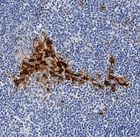 CXCL10/IP-10/CRG-2 antibody in Human Tonsil by Immunohistochemistry (IHC-P).