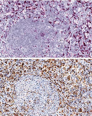 CXCL12/SDF-1a antibody in Human Tonsil Using Dual RNAscope®ISH and IHC.