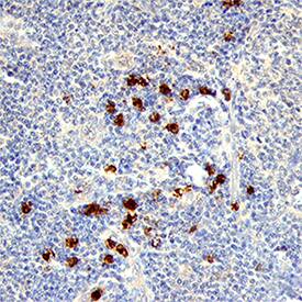 CXCL16 antibody in Human Lymphoma Tissue by Immunohistochemistry (IHC-P).