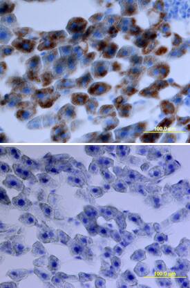 CXCL1/GROa/KC/CINC-1 antibody in Rat Liver by Immunohistochemistry (IHC-Fr).