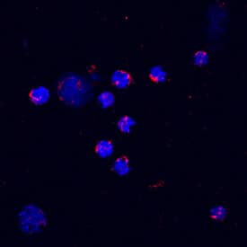 CXCL2/GRO beta/MIP-2/CINC-3 antibody in Mouse Splenocytes by Immunocytochemistry (ICC).