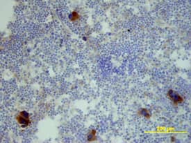 CXCL2/GRO beta/MIP-2/CINC-3 antibody in Mouse Spleen by Immunohistochemistry (IHC-Fr).