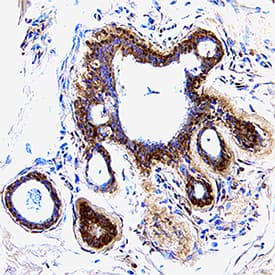 CXCL5/ENA-78 antibody in Human Breast by Immunohistochemistry (IHC-P).
