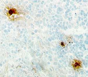IL-8/CXCL8 antibody in Human Tonsil by Immunohistochemistry (IHC-P).