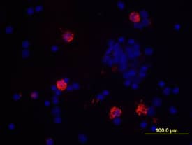 IL-8/CXCL8 antibody in Human PBMCs by Immunocytochemistry (ICC).