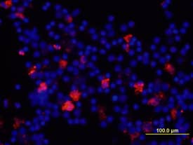 IL-8/CXCL8 in Human PBMCs. IL-8/CXCL8 antibody in Human PBMCs by Immunocytochemistry (ICC).