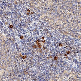 CXCR3 antibody in Human Tonsil by Immunohistochemistry (IHC-P).