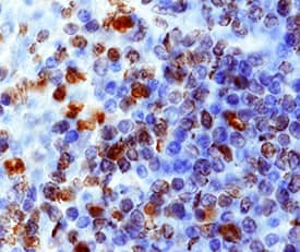 CXCR4 antibody in Human Spleen by Immunohistochemistry (IHC-P).
