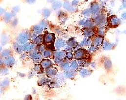 CXCR4 antibody in Human Lymph Node by Immunohistochemistry (IHC-P).