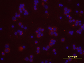 CXCR4 antibody in Mouse Splenocytes by Immunocytochemistry (ICC).